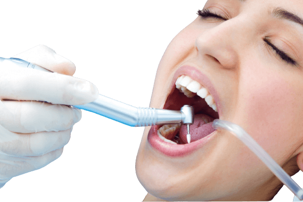 A dental implant model at Kayan Dental Clinics